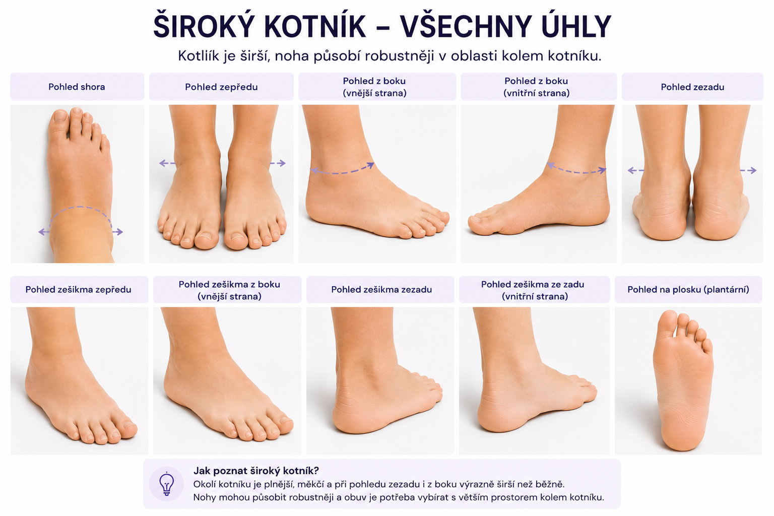 Široký kotník dítěte – fotografie chodidla z různých úhlů